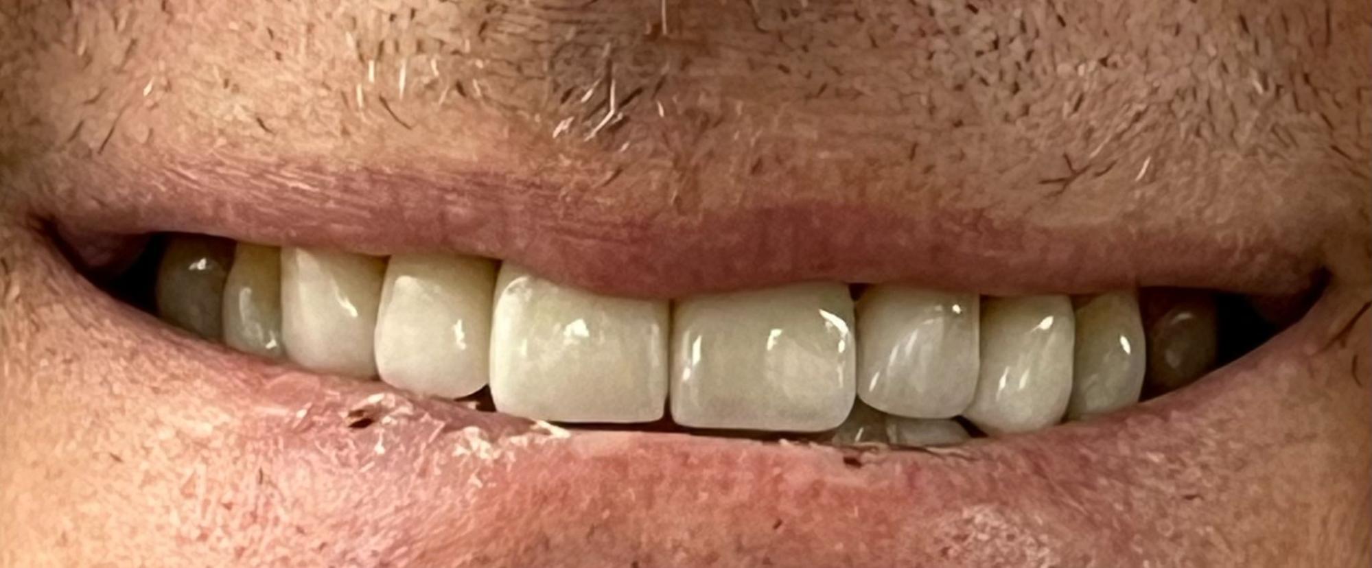 After dental treatment